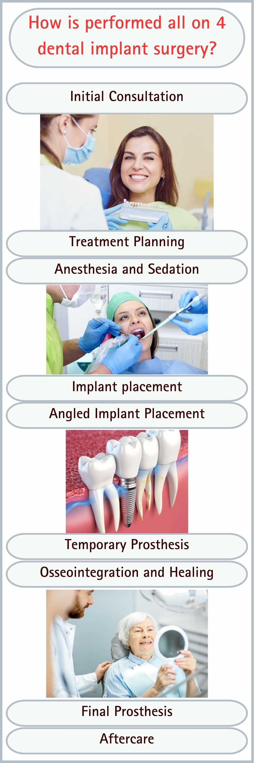 all-on-4 dental implants how is perfomed-turkey-antalya