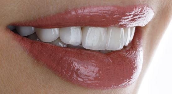 what-are-the-risks-and-success-of-porcelain-veneers-crowns-in-turkey