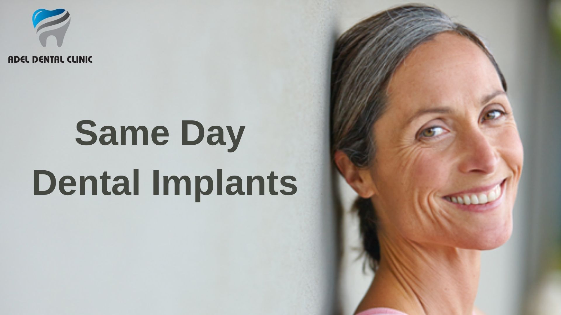 same-day-dental-implants-turkey-antalya