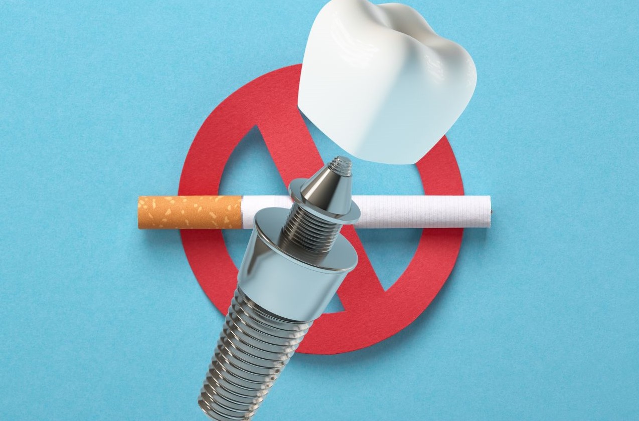 can-smokers-get-all-on-6-dental-implants-turkey-antalya