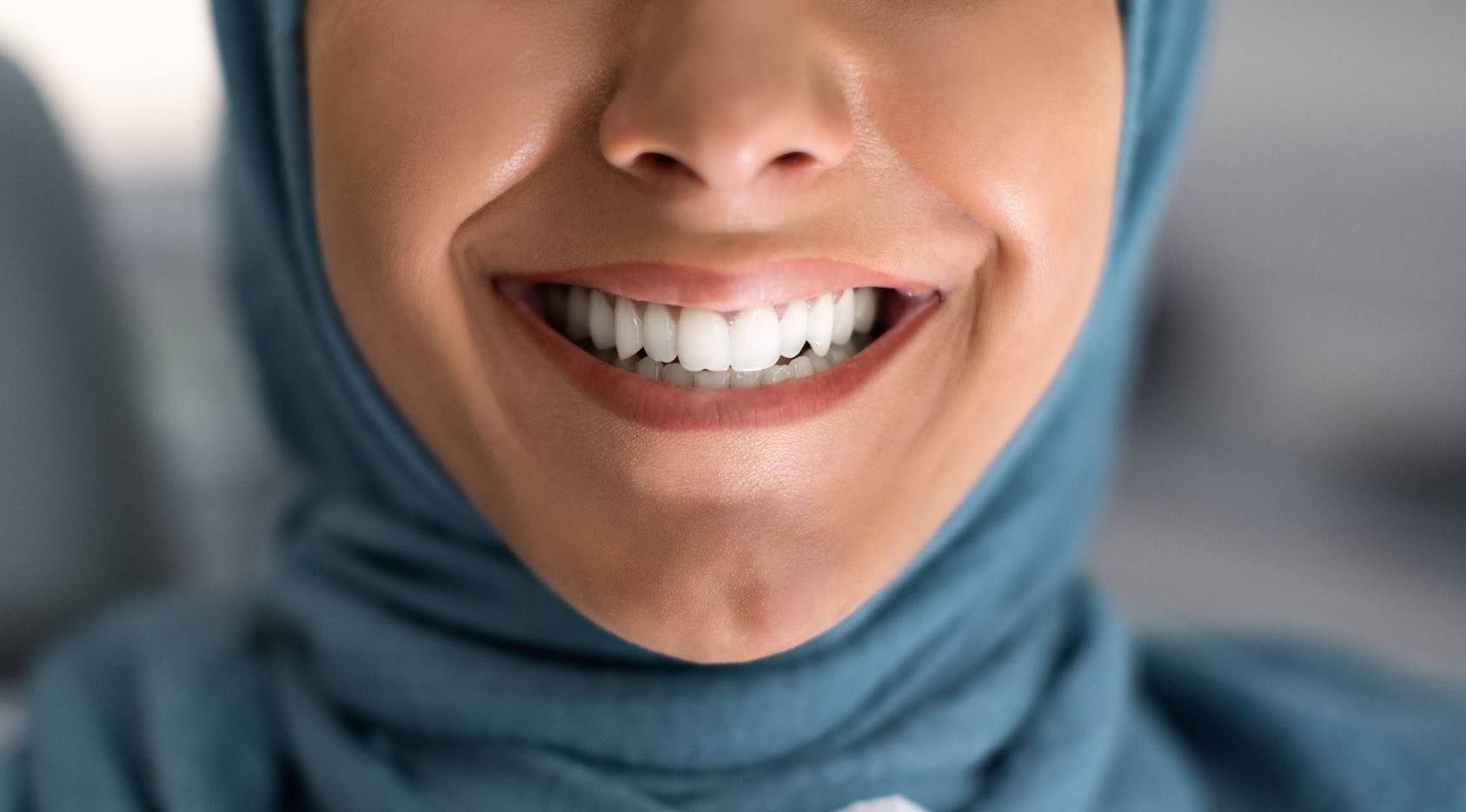 Who is suitable candidate for teeth whitening?-antalya-turkey