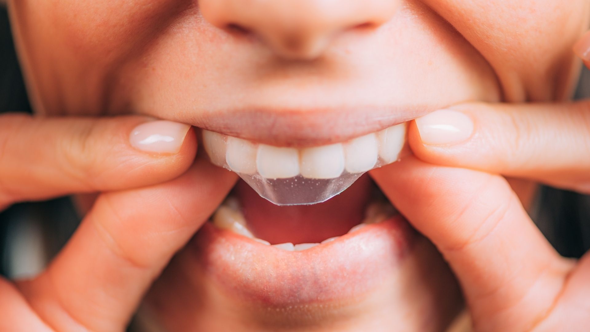 are-teeth-whitening-strips-harmful-to-teeth