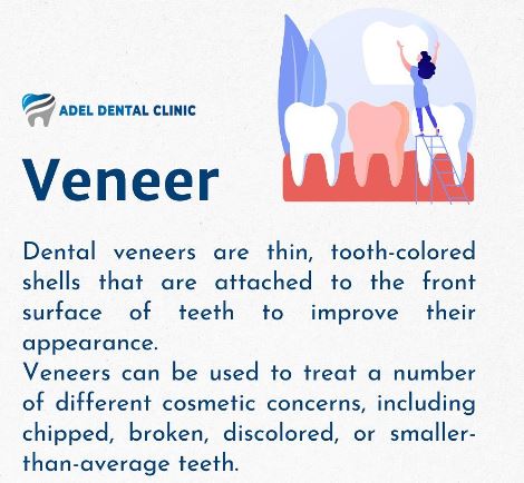 what is veneer?