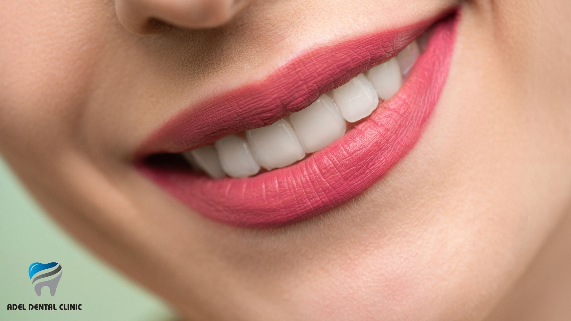 How to Keep White Teeth?