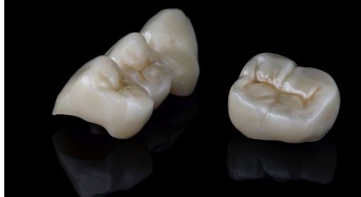 zirconium crown-2-antalya-turkey